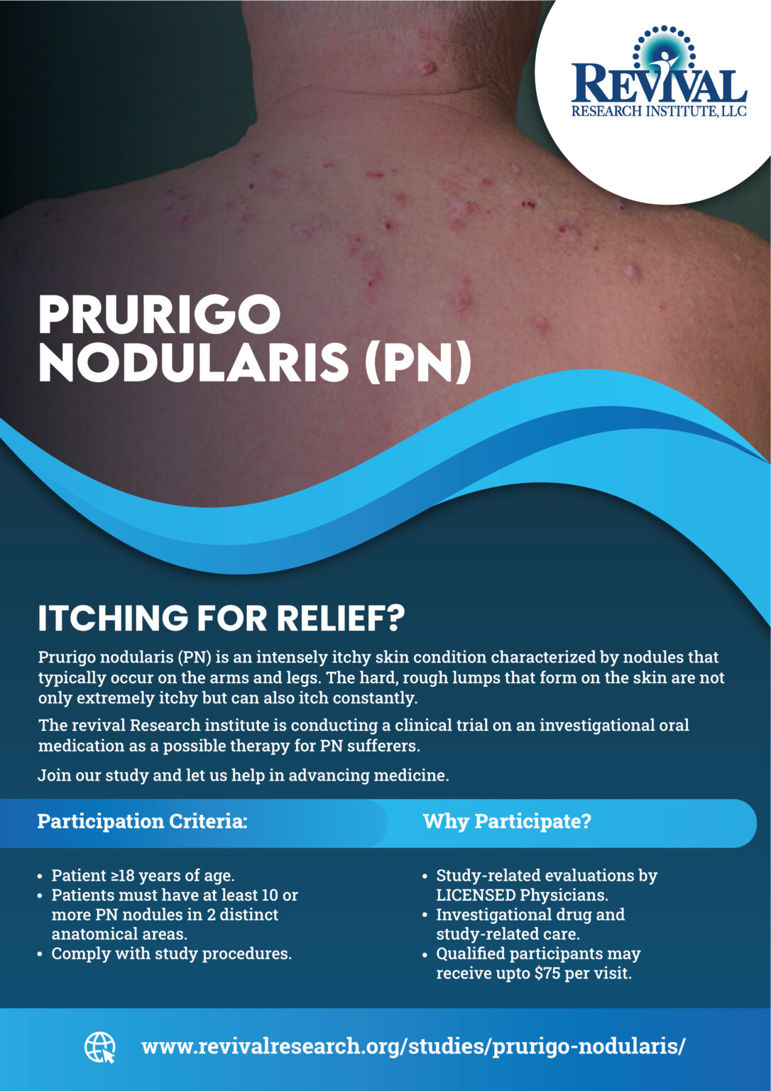 prurigo-nodularis-clinical-trials