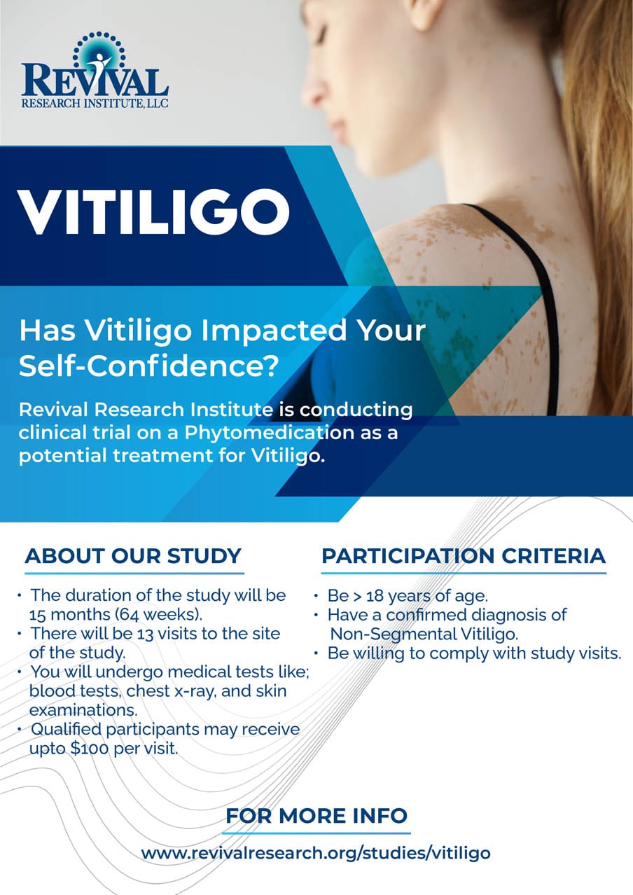 Sign Up for a Clinical Trial of Vitiligo Treatment Study