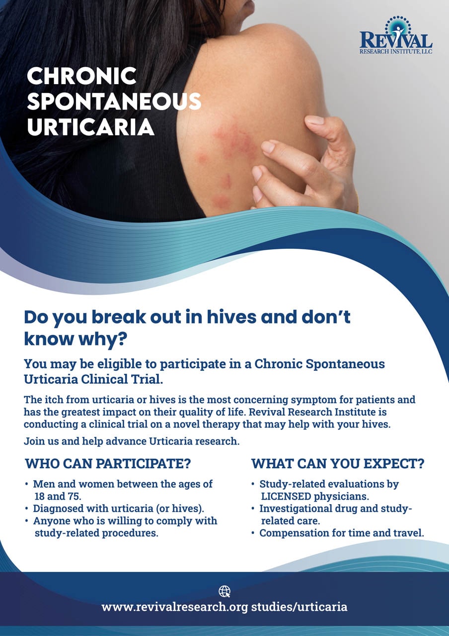 Sign Up for a Clinical Trial of Chronic Spontaneous Urticaria Study