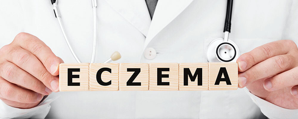 guide to living with papular eczema 