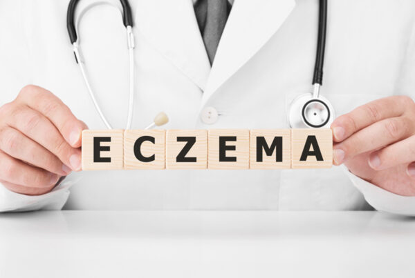 You’re Guide to Living with Eczema