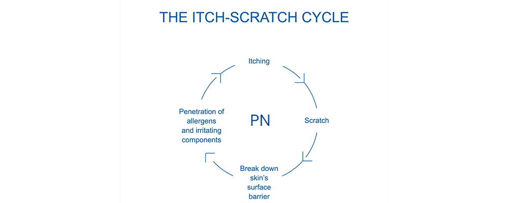 itch scratch cycle