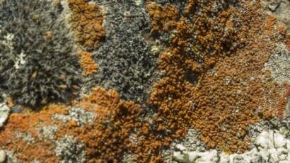 what is prurigo nodularis