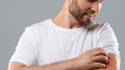 struggling with psoriasis