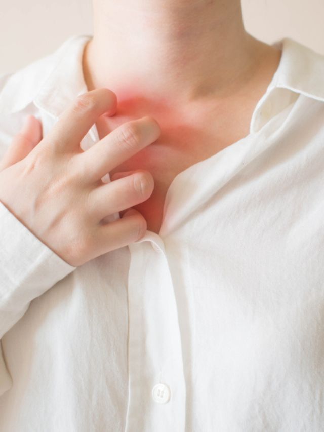 Breast Eczema: A Common Cause for Itchy Breasts - Revival Research
