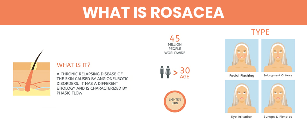 what is rosacea and types of Rosacea