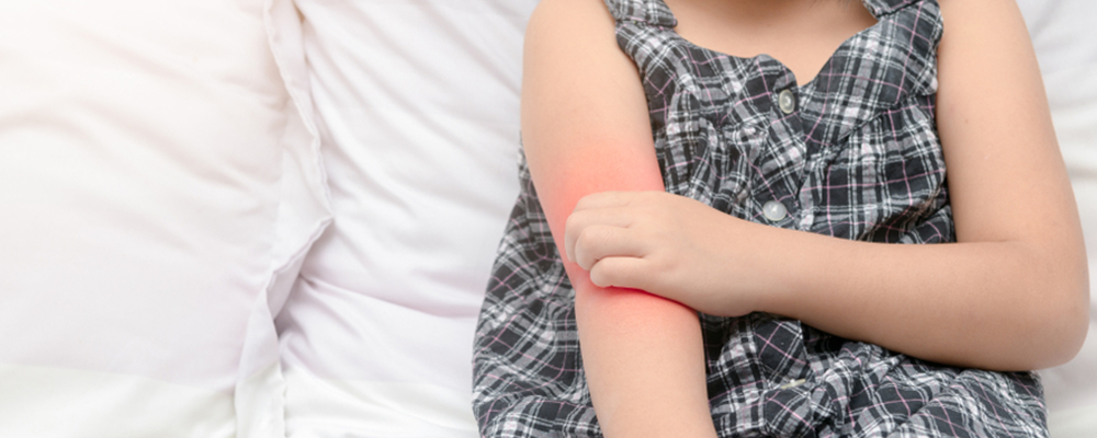 Eczema Coxsackium: Causes, Symptoms and Treatment