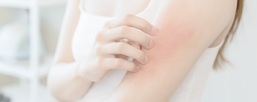 Dermatitis Herpetiformis vs Eczema