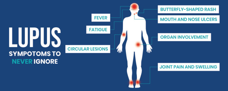 The Lupus Circular Rash and its Surprising Link to ASCVD