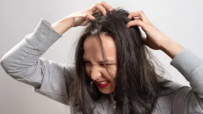 Scalp Psoriasis Vs Dandruff