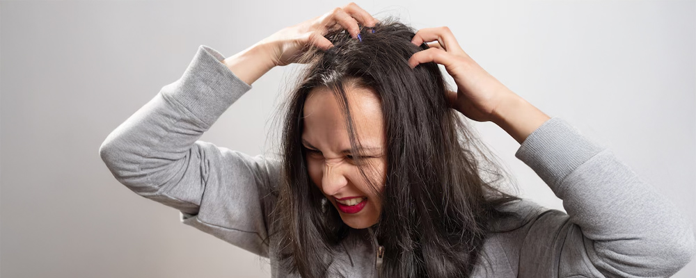 Scalp Psoriasis vs. Dandruff