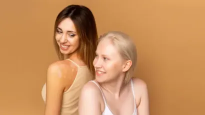 Albinism VS Vitiligo