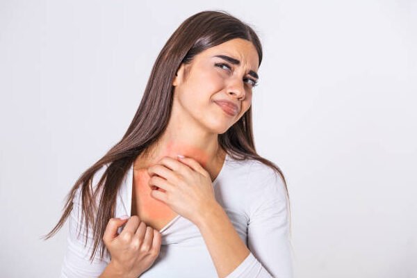 What Cancer Can Cause Itchy Skin