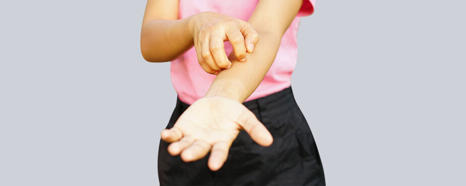 How To Stop Lichen Planus from Spreading on the Skin