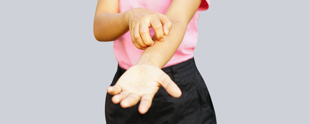 How To Stop Lichen Planus from Spreading on the Skin