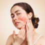 Types of Rosacea: How to Identify Each Type, and Care Tips