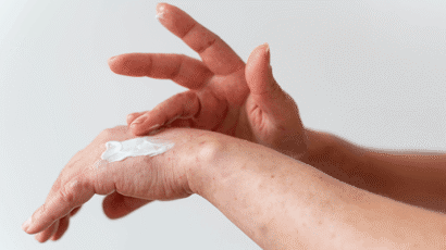 Hives vs Rash