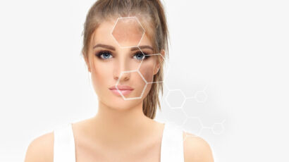 Is Rosacea Genetic