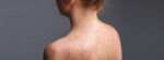 When to Worry About a Rash in Adults: Warning Signs and More