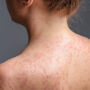 When to Worry About a Rash in Adults: Warning Signs and More