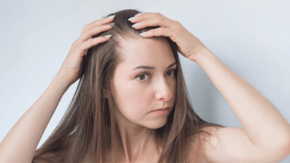 Alopecia Areata in Females