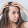 Alopecia Areata in Women: Signs, Causes, and Treatment Options