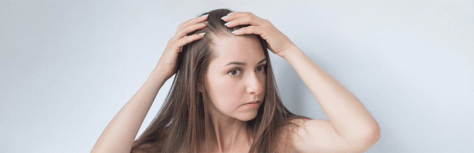 Alopecia Areata in Females