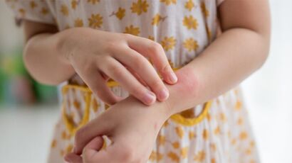 When To Worry About Rash On Child