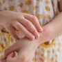 When To Worry About Rash On Child?