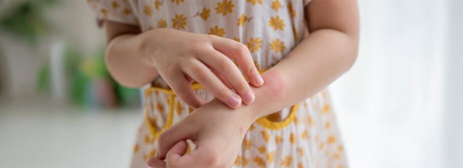 When To Worry About Rash On Child