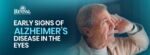 Early Signs of Alzheimer’s in the Eyes