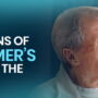 Early Signs of Alzheimer’s in the Eyes