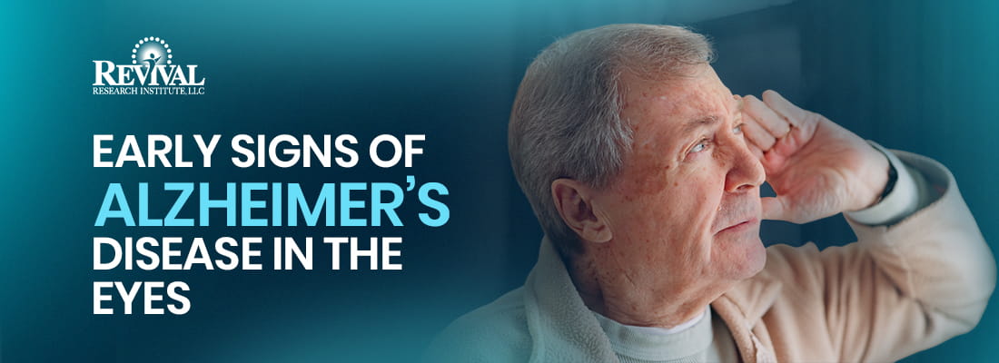 Early Signs of Alzheimer’s in the Eyes