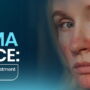 Eczema on Face: Causes, Symptoms, Treatment Options and More