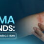 Eczema on Hands: Symptoms, Triggers, Relief, and More