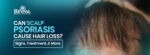 Can Psoriasis Cause Hair Loss? Signs, Treatment, and More