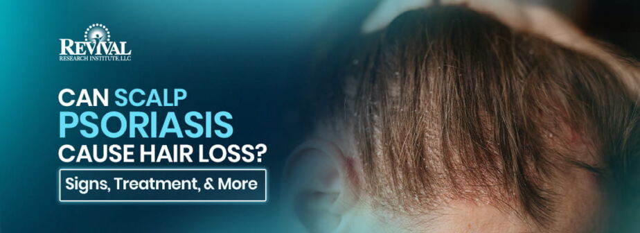 Can Psoriasis Cause Hair Loss