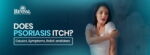 Does Psoriasis Itch? Causes, Symptoms, Relief, and More
