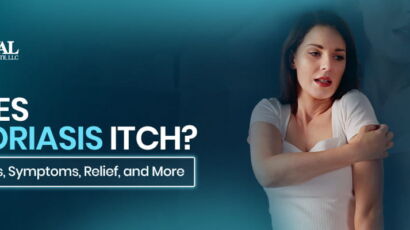 Does Psoriasis Itch?