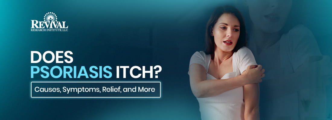 Does Psoriasis Itch?