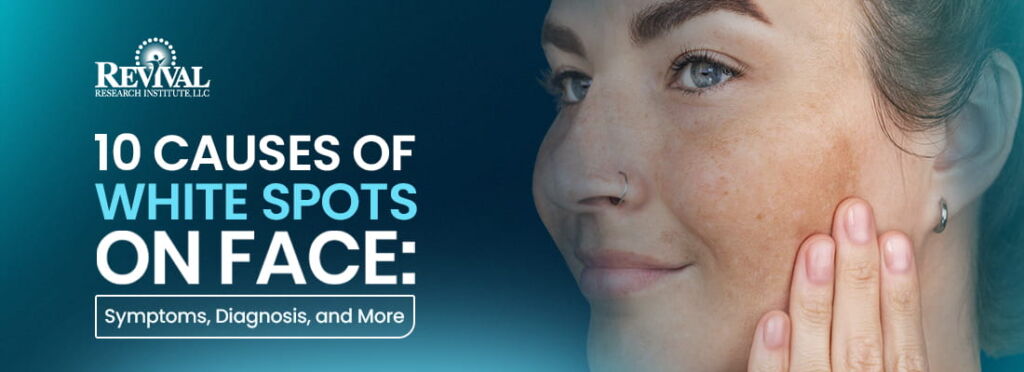 10-causes-of-white-spots-on-face