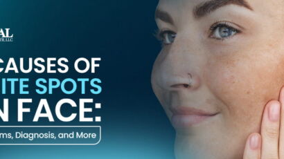 10-causes-of-white-spots-on-face
