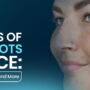 10 Causes of White Spots on Face: Symptoms, Diagnosis, and More