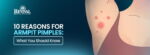 10 Reasons for Armpit Pimples: What You Should Know
