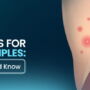 10 Reasons for Armpit Pimples: What You Should Know