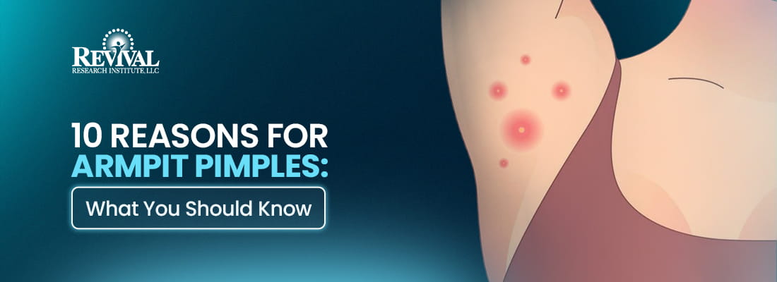 10 Reasons for Armpit Pimples