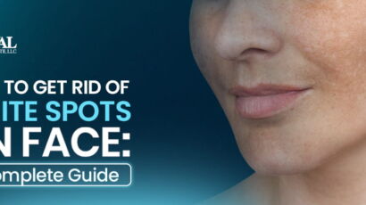 How to Get Rid of White Spots on Face? Learn what causes them, how to treat them naturally or medically, and when to see a dermatologist. Full guide.