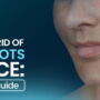 How to Get Rid of White Spots on Face: A Complete Guide