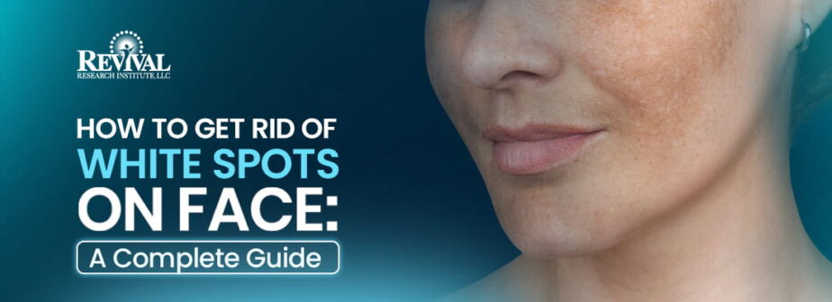 How to Get Rid of White Spots on Face? Learn what causes them, how to treat them naturally or medically, and when to see a dermatologist. Full guide.